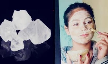 Multani Mitti Face Pack: मुल्तानी मिट्टी में फिटकरी मिलाकर लगाने से क्या होता है? जानें तरीका