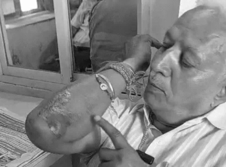 पाली में कांग्रेस मेयर प्रत्याशी का सिंबल जमा कराने के बाद विवाद, विधायक के भाई से मारपीट का आरोप